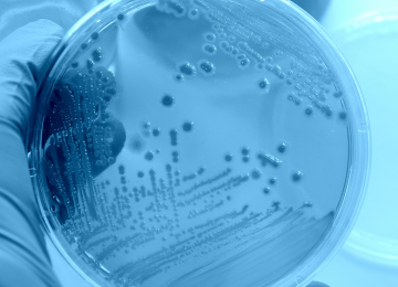 supplement-microbiological-testing